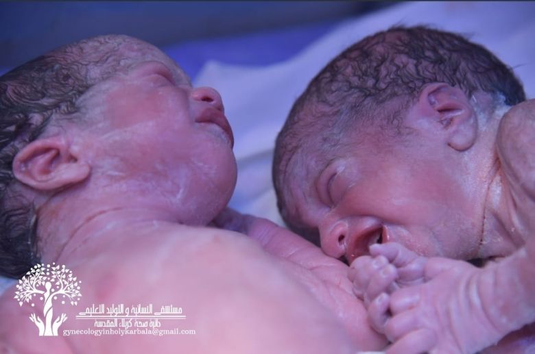 خلال شهر واحد .. مُستشفى حكومي بكربلاء يشهد ولادة أكثر من ( 1760) طفلاً